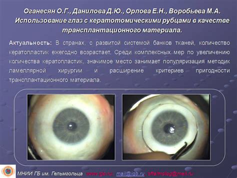 Использование глаз Ендермана