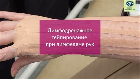 Использование холода для уменьшения отека век