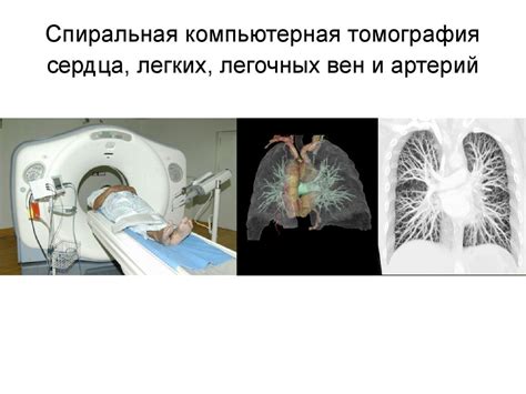 Исследования о вреде от КТ легких: что говорят ученые?