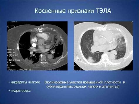 КТ-сканирование легких: применение в диагностике разных заболеваний