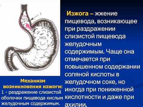 Какие причины возникновения полипов в пищеводе?