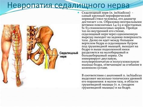 Какие симптомы указывают на защемление седалищного нерва?