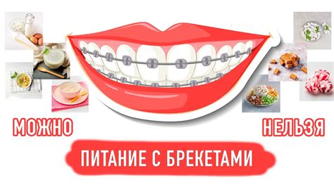 Какие сладости можно есть с брекетами?