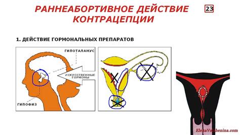 Какие факторы могут влиять на изменения цикла после удаления спирали