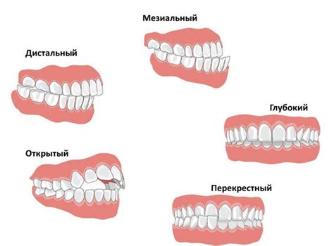 Как влияет неправильный уход на прирост лоскута?