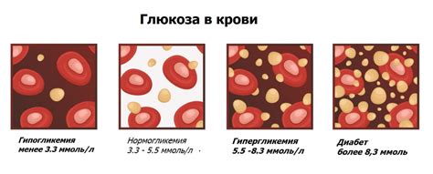 Как влияет сухое вино на уровень глюкозы в крови