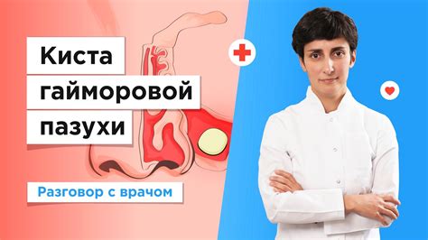 Как выбрать подходящие средства для гретья кисты гайморовой пазухи