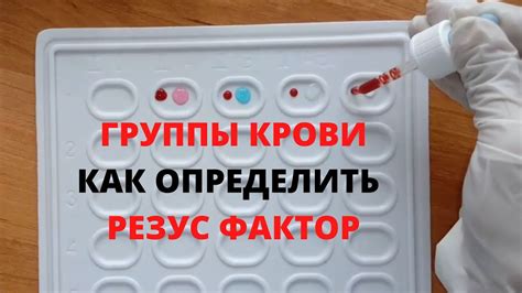 Как избежать ошибок при определении группы крови?