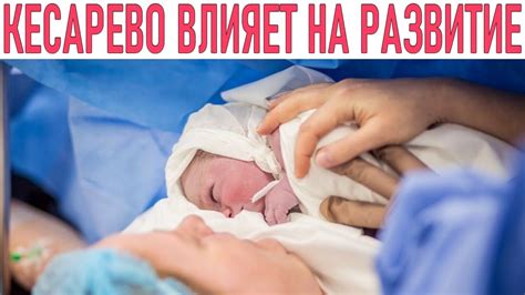 Как кесарево сечение влияет на здоровье ребенка