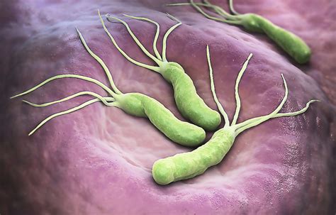 Как лечить инфекцию Helicobacter pylori