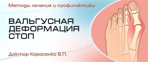 Как определить вальгусную деформацию?