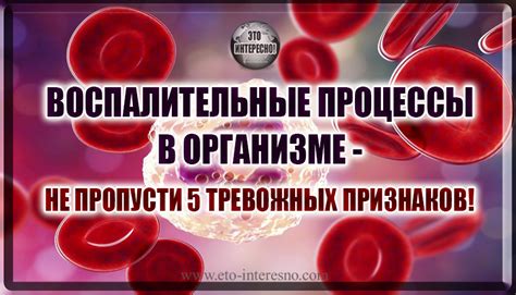 Как подавление чиха может повлиять на воспалительные процессы в организме?