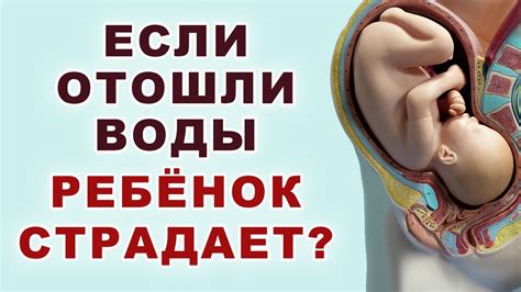 Как помочь ребенку при начале движения после отхождения вод?