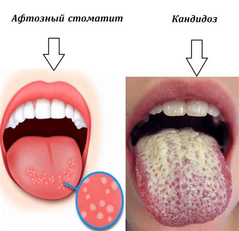 Как предотвратить горечь во рту от семечек