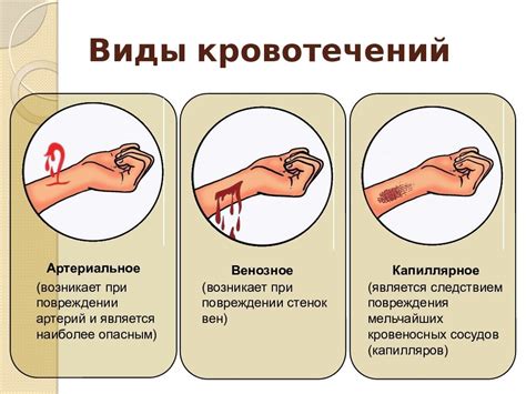 Как предотвратить кровотечение при лопании фолликула