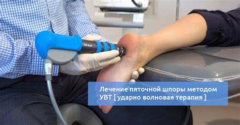 Как проводить УВТ для лечения пяточной шпоры?