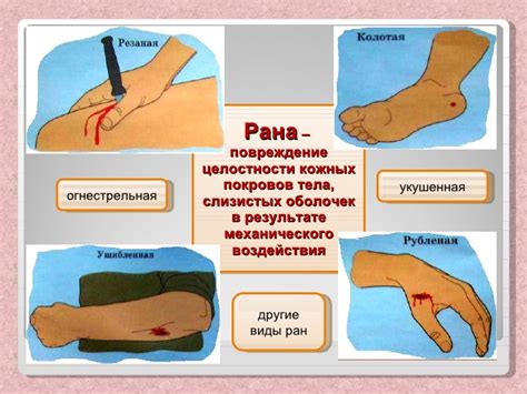 Как проходит обработка гнойной раны перекисью?