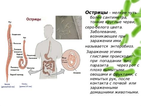 Как проявляется тошнота при заражении глистами