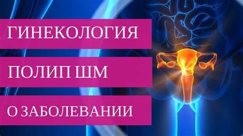 Как различить полип матки от других заболеваний?