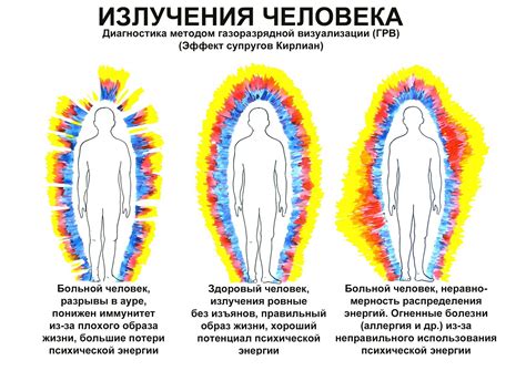 Как создать узел аура на 1000 вис - советы и методы