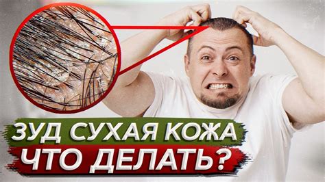 Как уменьшить длительность зуда головы