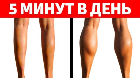 Как уменьшить икры на ногах