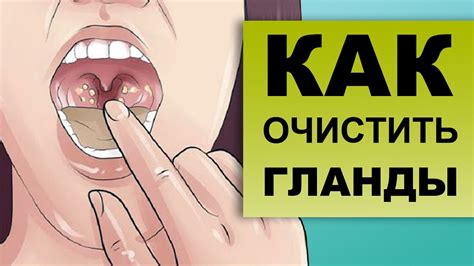 Как эффективно очистить гланды от белых пробок