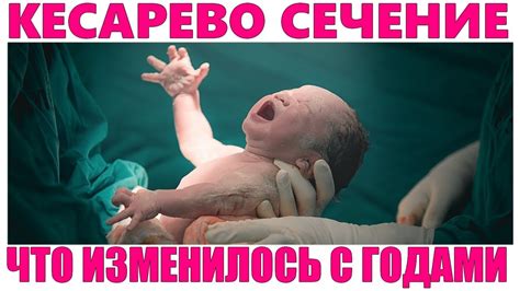 Кесарево сечение во второй раз: подходит ли для родов?