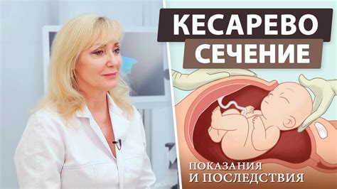 Когда необходима кесарево сечение?