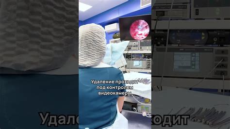 Когда необходимо провести удаление полипа в пищеводе?