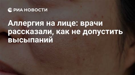 Консультация специалиста при аллергии на мяту у взрослого