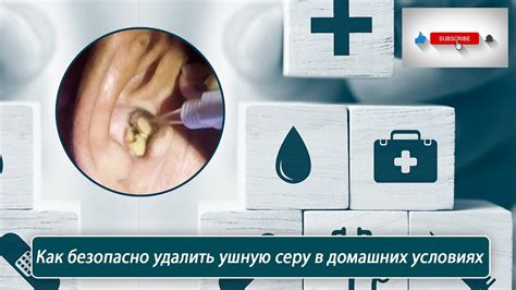 Методы, которые помогут вам устранить ушную серу