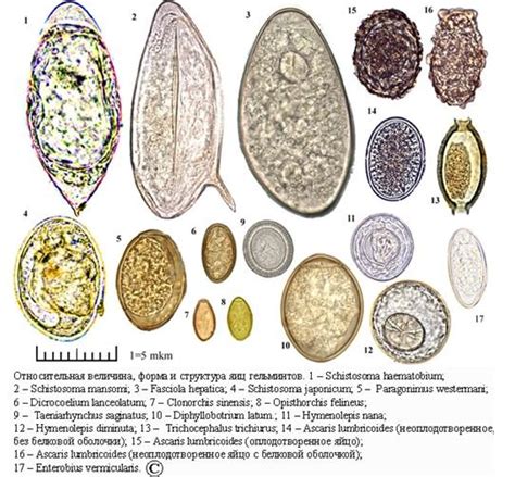 Методы диагностики гельминтозов