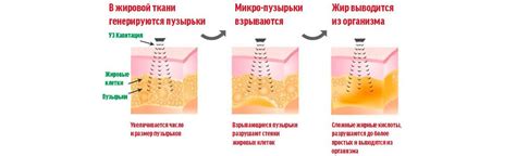 Методы диагностики кавитации