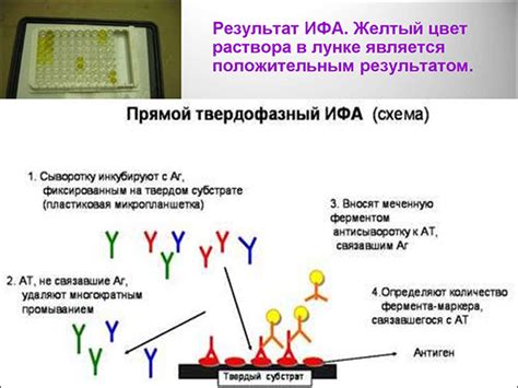 Методы диагностики уреаплазмы через анализ мочи