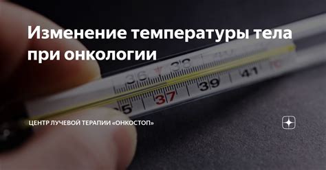 Методы контроля температуры тела после лучевой терапии