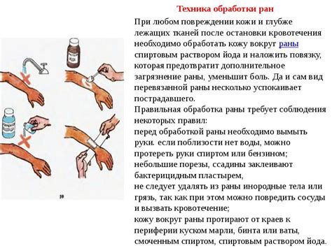 Методы обработки гнойной раны