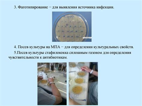 Методы профилактики стафилококковой инфекции