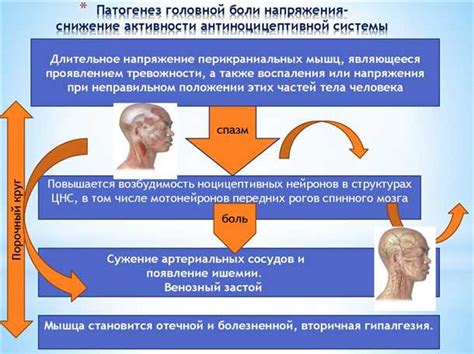 Механизмы возникновения мигрени и их связь с рвотой