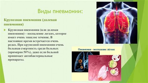 Механизм развития ОРВИ и пневмонии