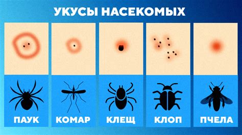 Мифы о домашних пауках: чем опасны укусы?