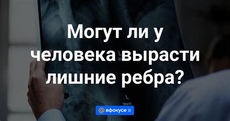 Могут ли у человека вырасти рога