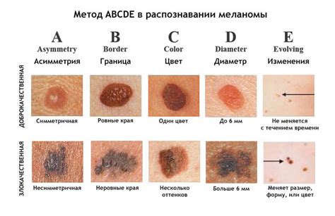 Может ли меланома повлиять на рост волос?