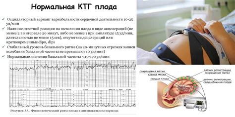 Можно ли есть перед КТГ плода?