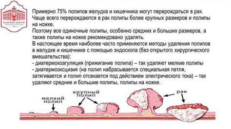 Можно ли появление полипов после удаления?