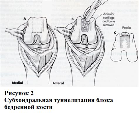 Моменты проявления коленной чашечки у ребенка