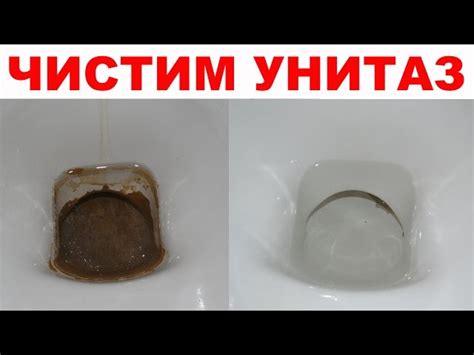 Мочевой камень и его последствия