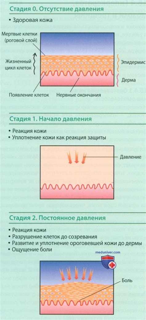 Наиболее популярные методы удаления мозолей