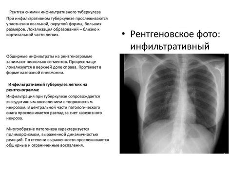 Научные исследования по вопросу кормления при пневмонии