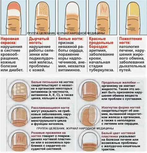 Необходимость стрижки ногтей при болезни